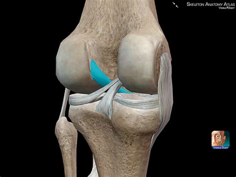 Common Ligament Injuries And Disorders