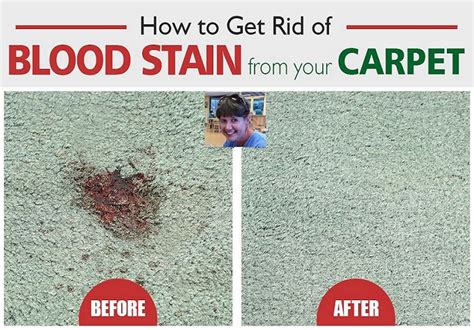clean blood stains   carpet southern carpet cleaning