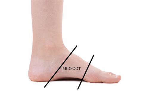 midfoot arch pain ankle foot  orthotic centre