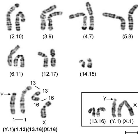 Dapi Banded Karyotype Equivalent To A G Banded Of A Xy Female With A