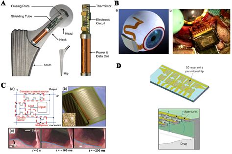electronics  full text implantable devices issues  challenges