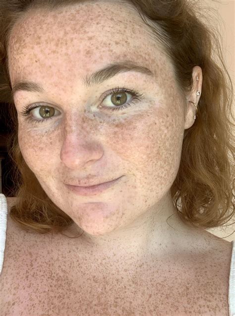 my freckled face 💕 r freckledgirls