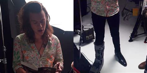 harry styles wears giant boot for his broken foot here s