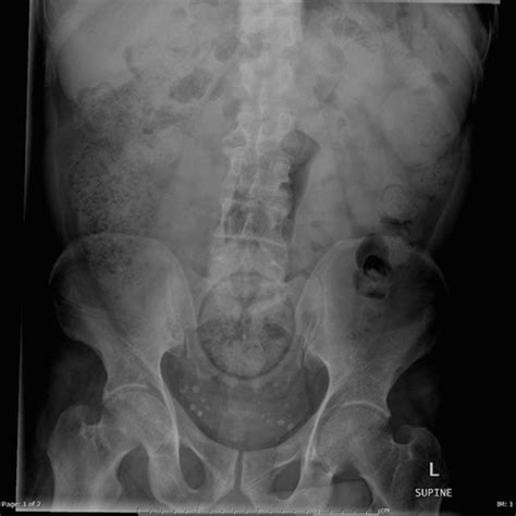 Website Compiles X Ray Photos Of Weird Things Stuck Up