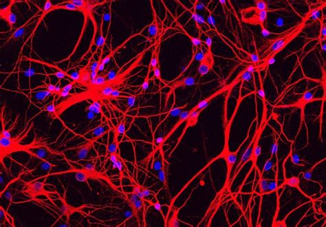 astrocyte  neuron method reverses neurodegeneration  mice