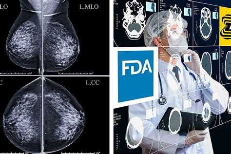 zebra medical vision secures its first fda clearance in oncology