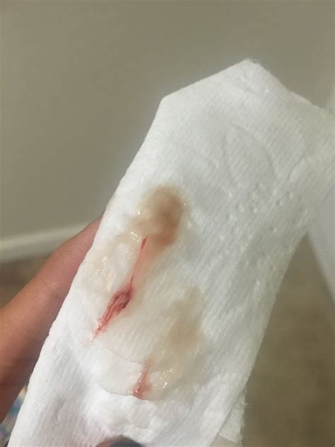 bleeding when first pregnant porn pics and movies