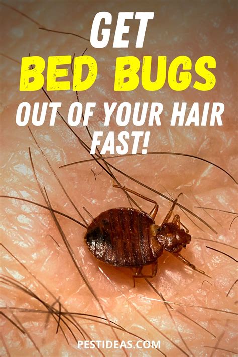 get rid of bed bugs in hair how did they get in your hair