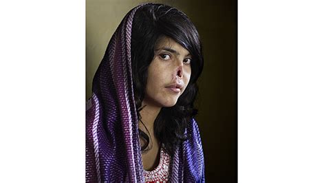 picture of disfigured afghan woman wins world press photo award fox news