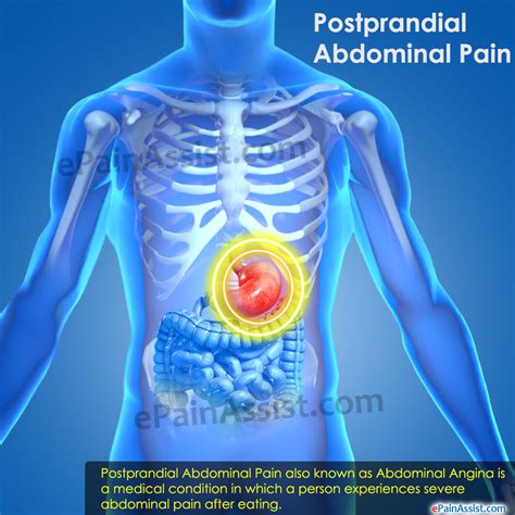 postprandial abdominal paincauses symptomstreatment