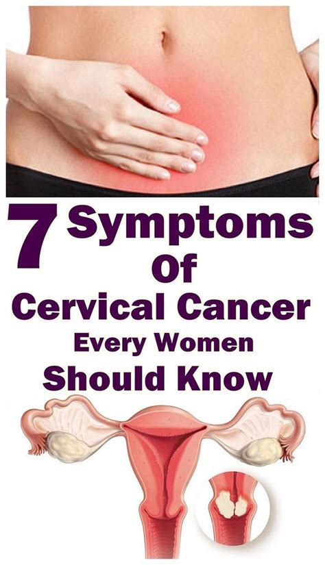 7 Warning Symptoms Of Cervical Cancer That Every Women