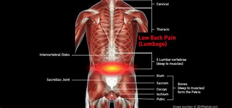 Low Back Pain Lumbago Thermoskin Supports And Braces