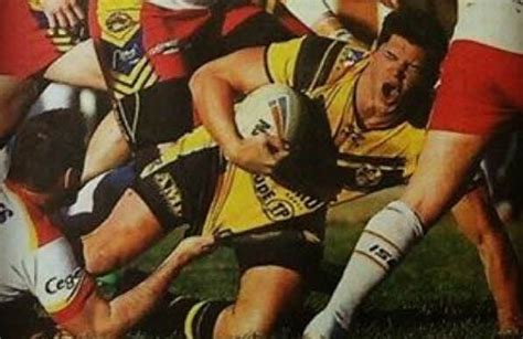 This Rugby Player Got His Penis Ripped During A Game