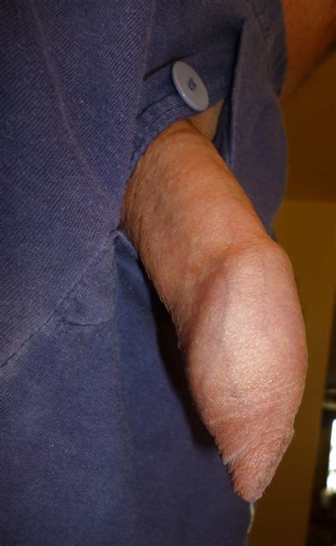Very Small Dick With Long Foreskin 56 Pics Xhamster