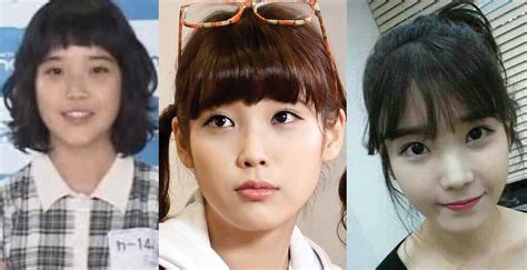 Iu Plastic Surgery Before And After Pictures 2020