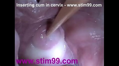 insertion semen cum in cervix wide stretching pussy speculum xnxx