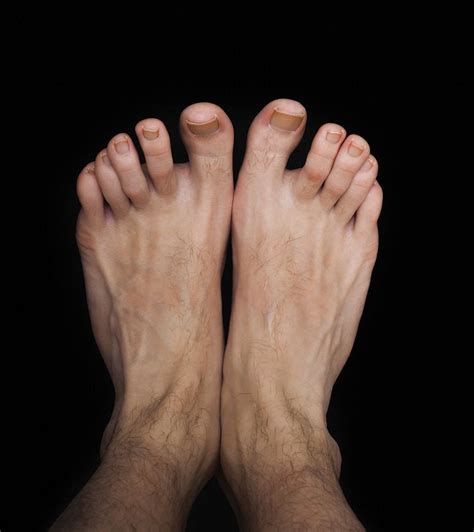mans secret shame  gnarly feet health daily journalcom