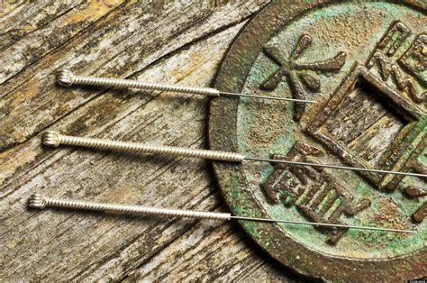acupuncture relieves stress  understanding    ancient