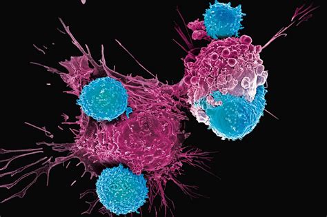 Cancer Immunotherapy Discovery And Development