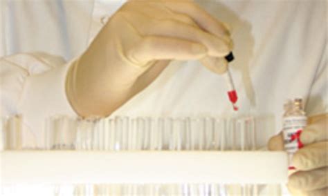 qc reagents  blood sciences laboratory talk