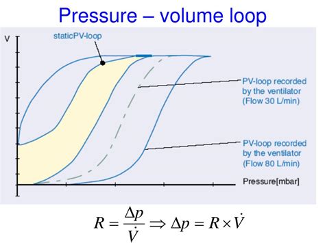 interpretation  ventilator graphics powerpoint