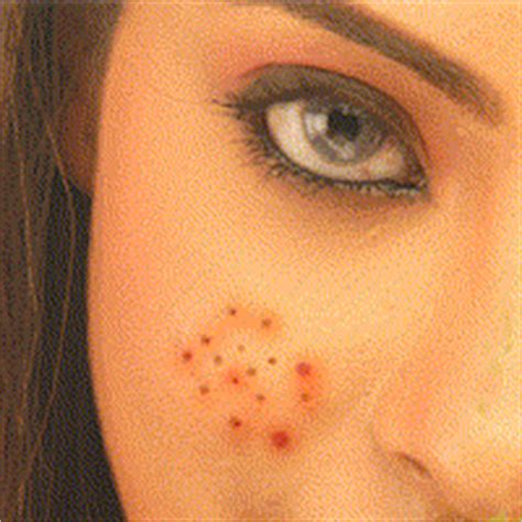 health  fitness pimples care