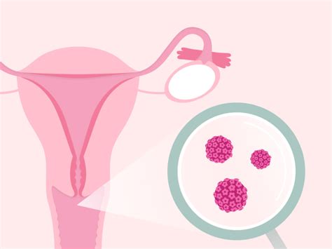 Abnormal Pap Smear What Happens Next Flo