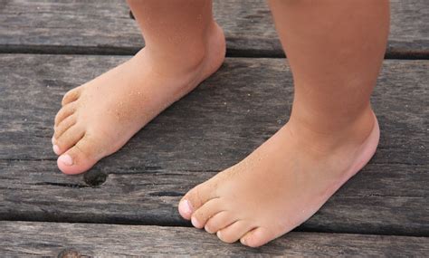 cómo saber si un niño tiene pies planos imujer