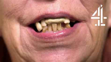 woman with no teeth hides it with chewing gum never seen