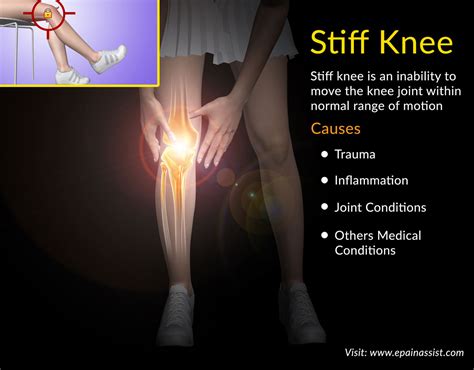 Stiff Knee Causes Best Exercises Recovery Period