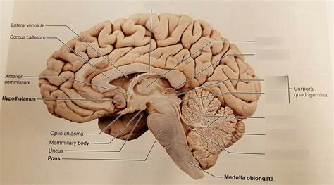 sagittal view   human brain brain sagittal  vrogueco
