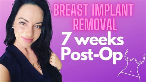 Breast Implant Removal Success Why I Kept My Capsules 7 Weeks Post