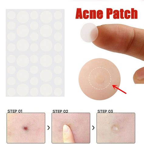36pcs skin tag remover patch not sold in stores