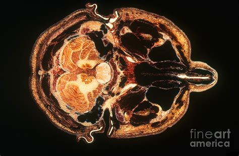 slice  human brain photograph  science source fine art america