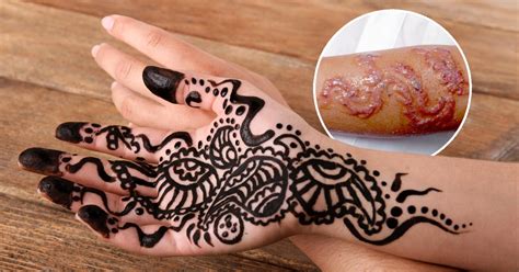 ash kumar explains how to tell if someone s using illegal black henna