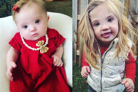 Mother Of Beautiful Down Syndrome Girl On How She