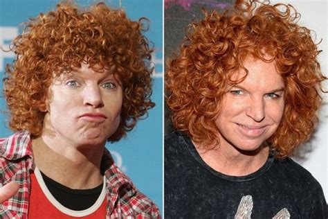 The Worst Plastic Surgery Disasters Of All Time Barnorama