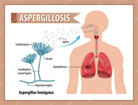 aspergillus