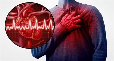 sleep problems can increase risk of cardiovascular events in stroke