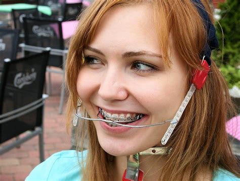 pin by jamie richie on girls with headgear and braces in 2021 braces