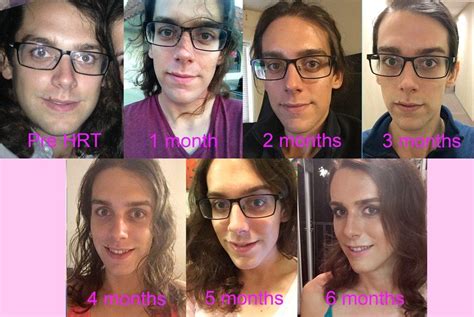 Transgender Transitions Transgender Transition Timelines