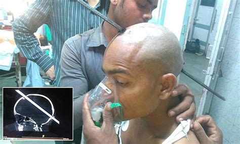 mumbai construction worker s brain is pierced by seven foot long iron rod daily mail online