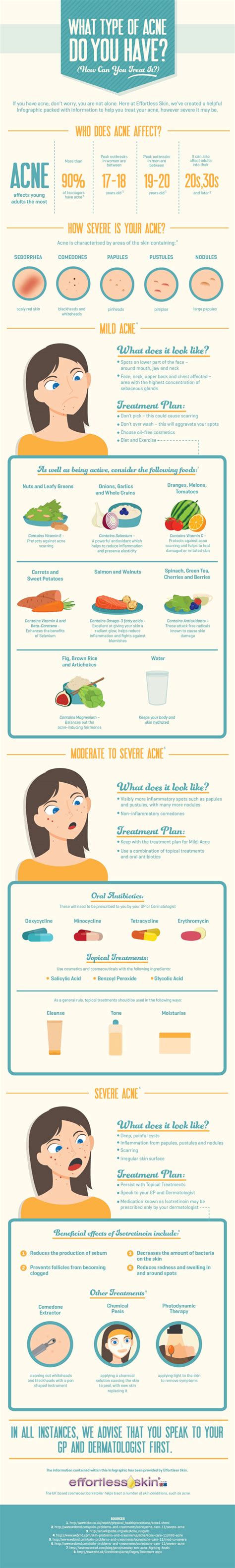 how severe is your acne how can you treat it infographic