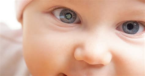 congenital cataract     infant   surgery