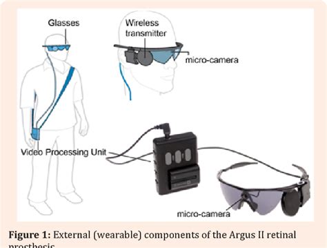 bionic eye  glance   argus ii retinal prosthesis semantic scholar