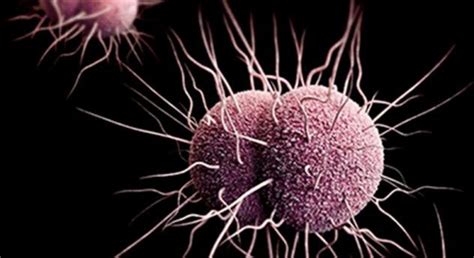 10 frightening facts about gonorrhea listverse