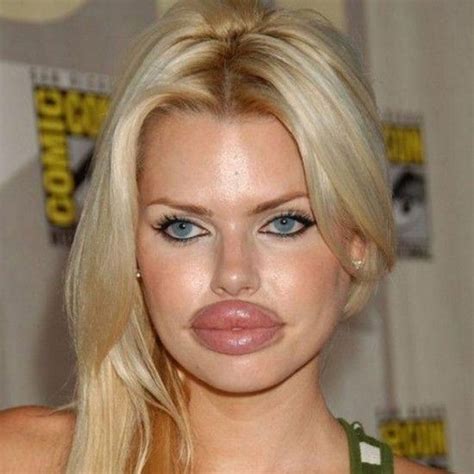 10 Plastic Surgery Faces That Went Horribly Wrong Bad