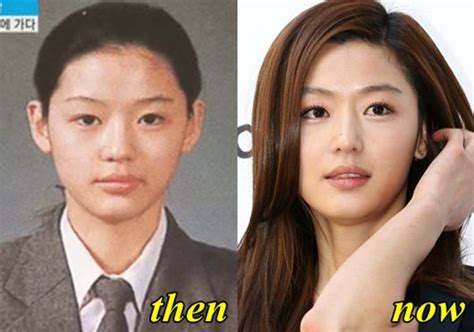 Kim Ji Soo Plastic Surgery Plastic Surgery Celebrity