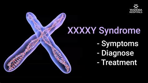 49xxxxy Syndrome Symptoms Diagnosis And Treatment Health Tips