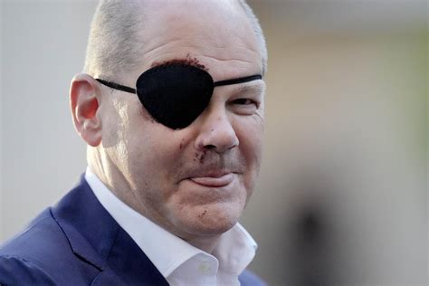 german chancellor olaf scholz dons eye patch  jogging accident